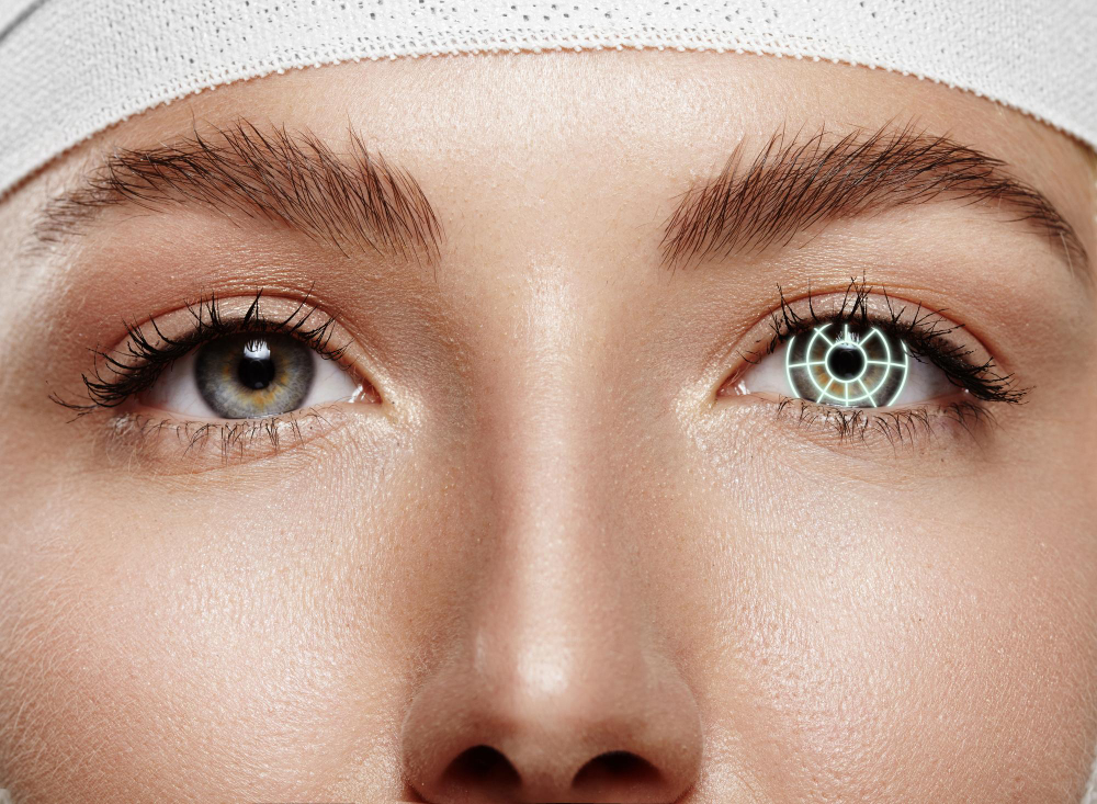 LASIK Eye Surgery Procedure